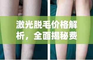 激光脱毛价格解析,全面揭秘费用因素!